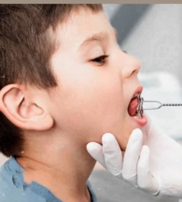 Логопед дефектолог