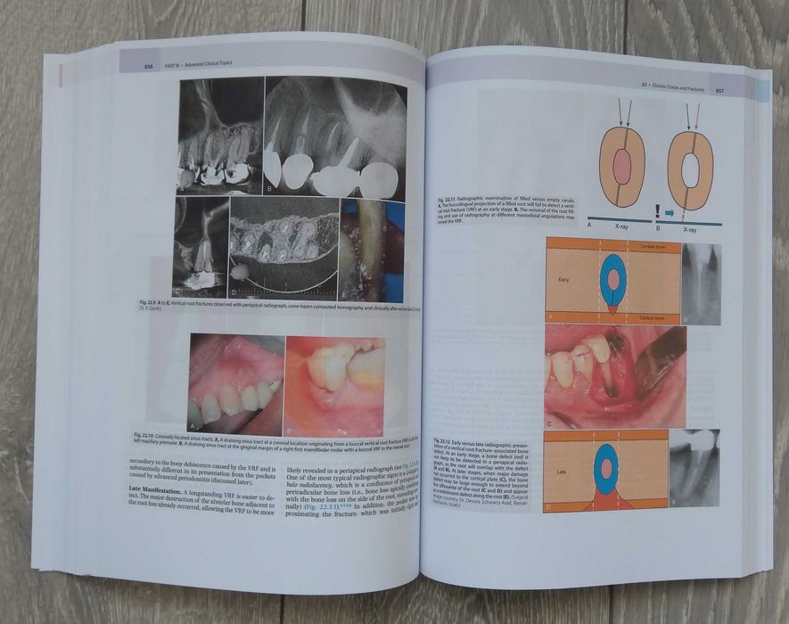 Cohen's Pathways of the Pulp: 12th Edition Engleza