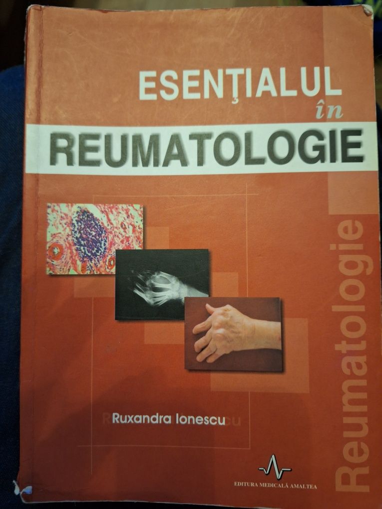 Esentialul in reumatologie - Ruxandra Ionescu