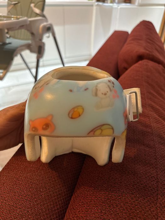 Ортопедическая каска (шлем)