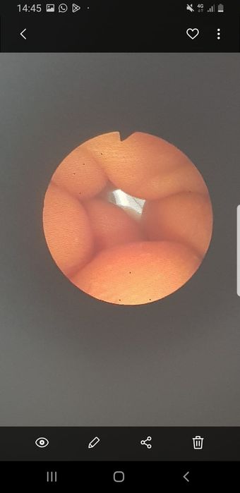 Endoscop Fibroscop Olympus Pentax Storz Medstar/Medvision