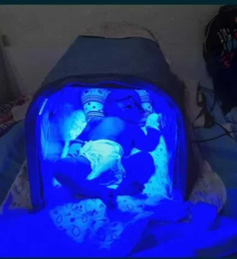 Fotolampa uy sharoitida.Fotolampa sariqlika arenda.Фотолампа бола учун