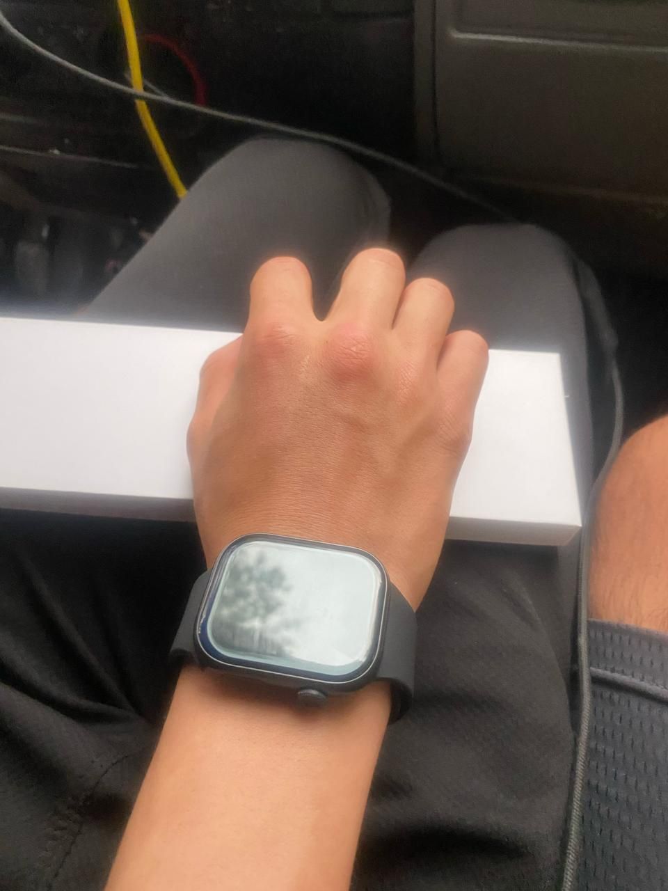 Apple Watch series 10