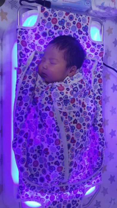 Лампа билитест билирубин