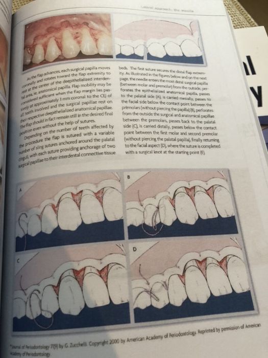 Mucogingival Esthetic Surgery - Giovanni Zucchelli