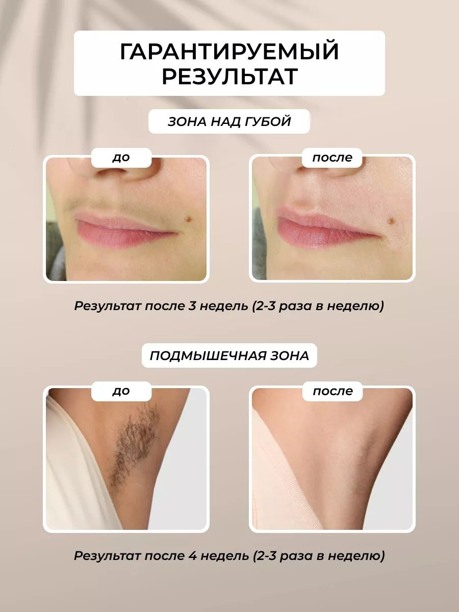 Фотоэпилятор Doctor comfort 2в1 омоложение и антиакне