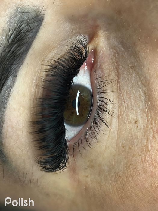 Aplic extensii de gene