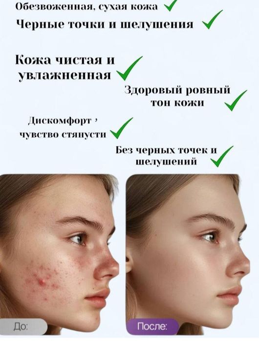 Carich Greenleaf Sealuxe skrap krem
