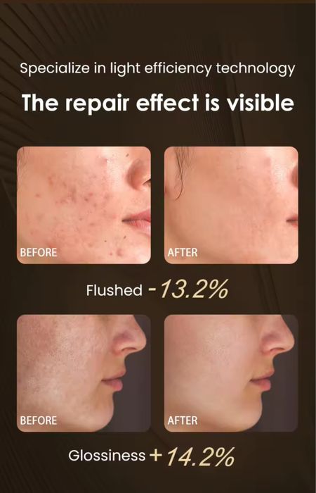 Висок клас LED маска с 2г. гаранция