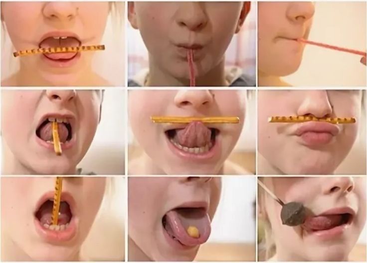 Logopedie pentru copii