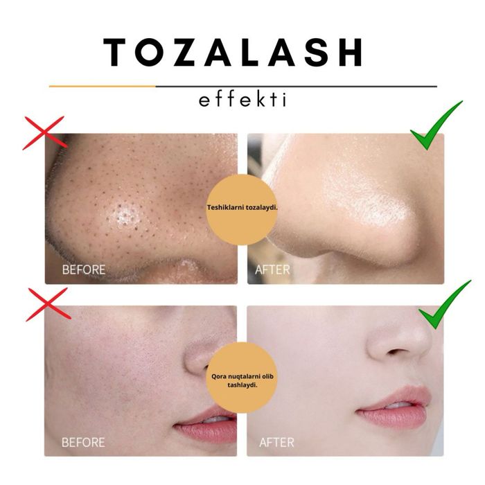 Han Lun Meiyu teshiklarni tozalovchi niqob-plyonka