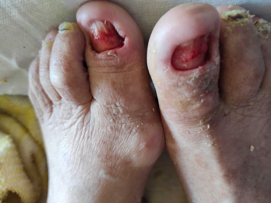 Медицински педикюр по домовете