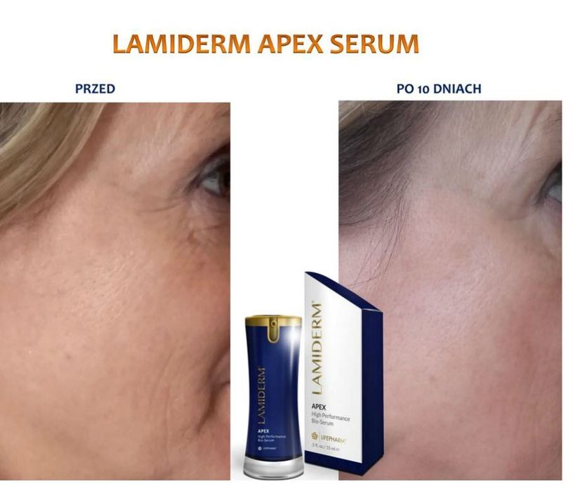 Lamiderm serum Apex – serul de piele