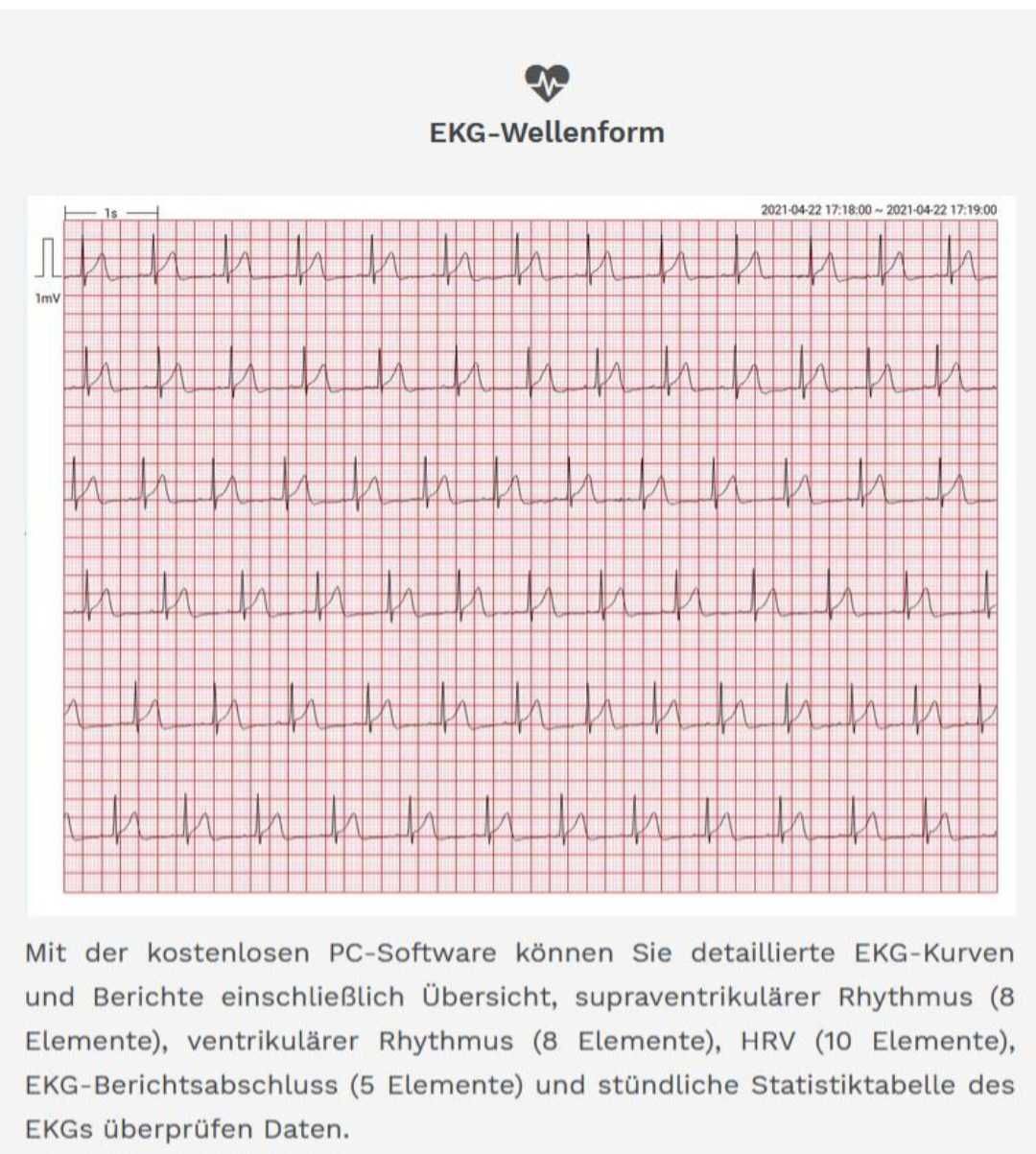 Holter ECG pe termen lung Viatom/Wellue ER1