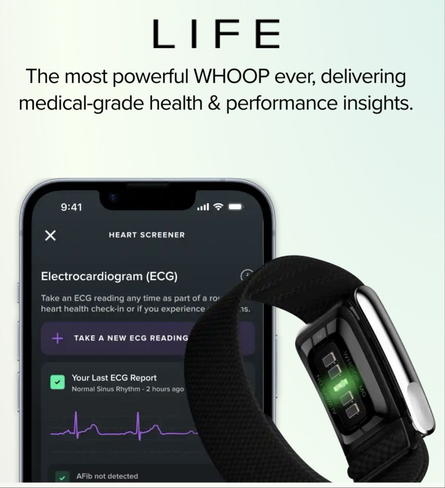 WHOOP MG 5.0 Life с годовой подпиской