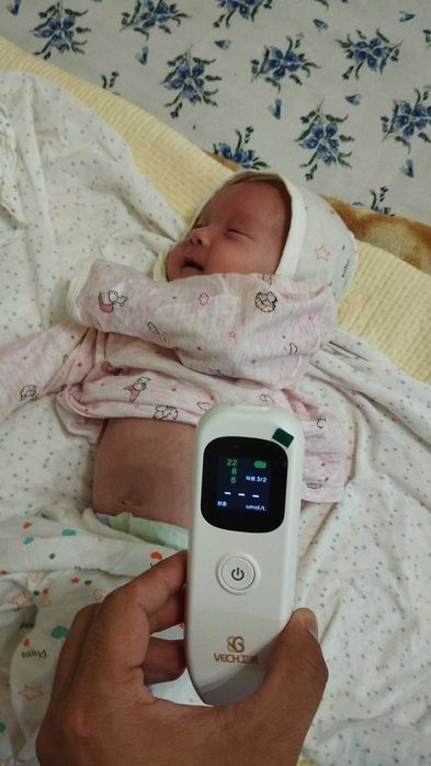 Билрубин олчаб бериш. Служба измерения билирубина