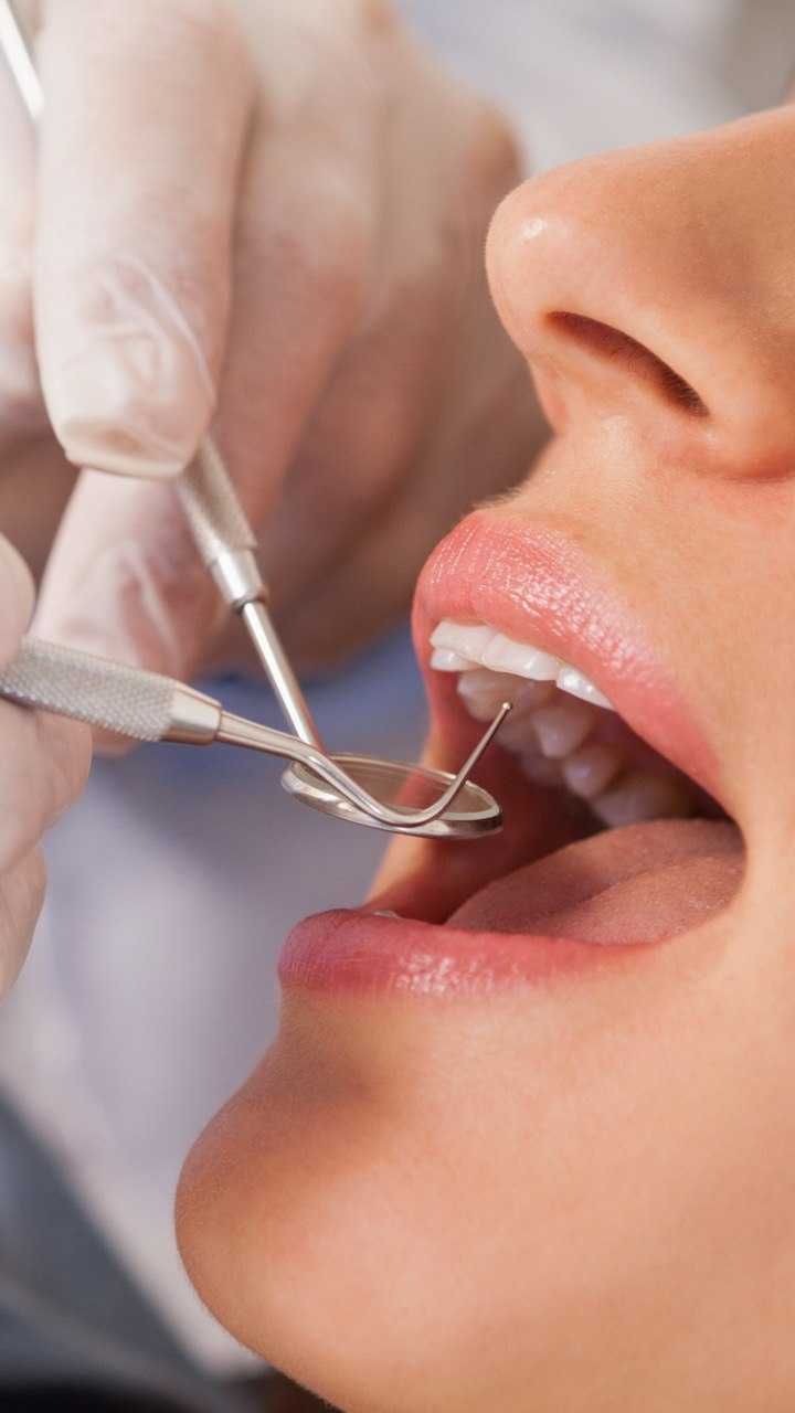 Лечение зубов Алматы