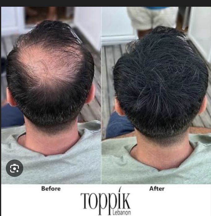 Pachet Toppik Pro - fibre pentru par rar - Livrare Bucuresti instant!