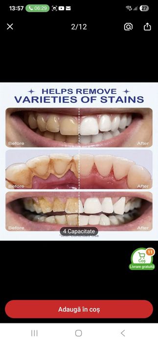 Aparat dentar pt curățare tartru și pete dentare Nou * Reducere 50% !