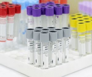 Пробирка в наличие зелёный пробирка с гепарин гелем 3000 сум за шт