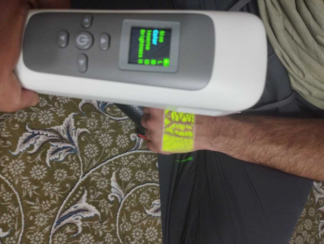 Vein Finder Венавизор 700$ Srochna