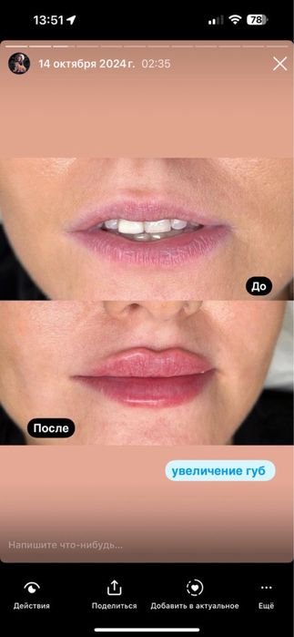Увеличение губ // Перманент бровей и губ