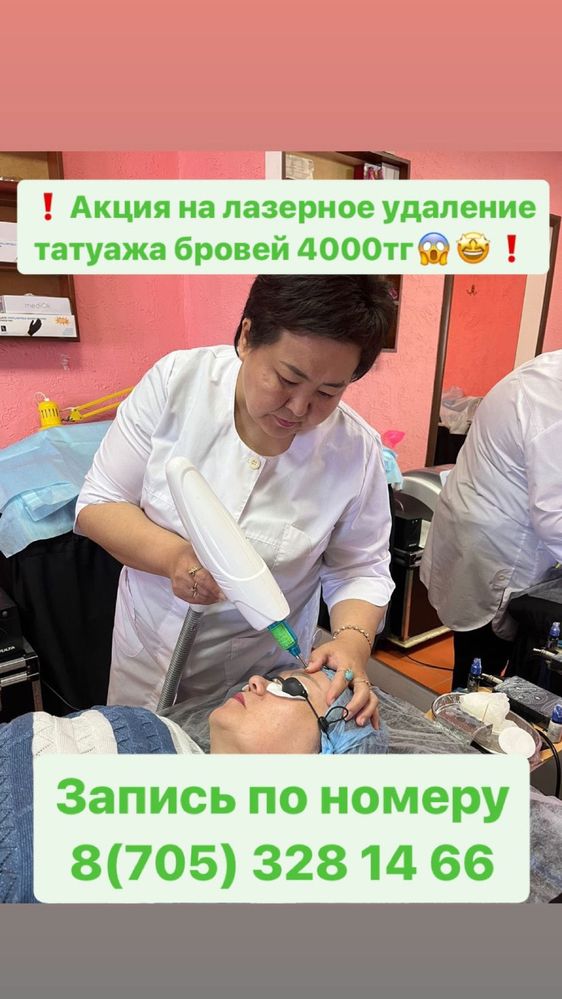Лазерное удаление татуажа бровей Аксай