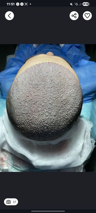 Soch ekish xizmati. Kuzgi chegirmada.