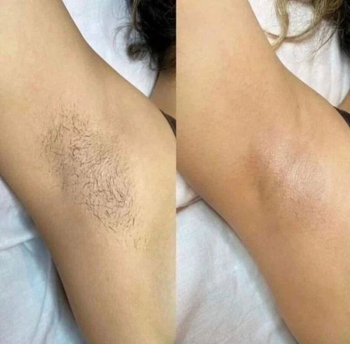 Шугаринг на дому только для женщин