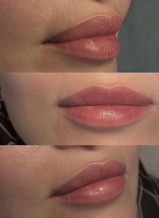 Услуги косметолога