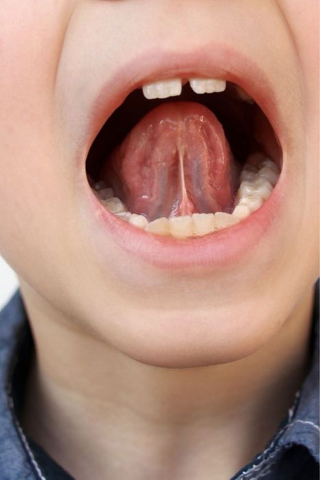 Логопед дефектолог