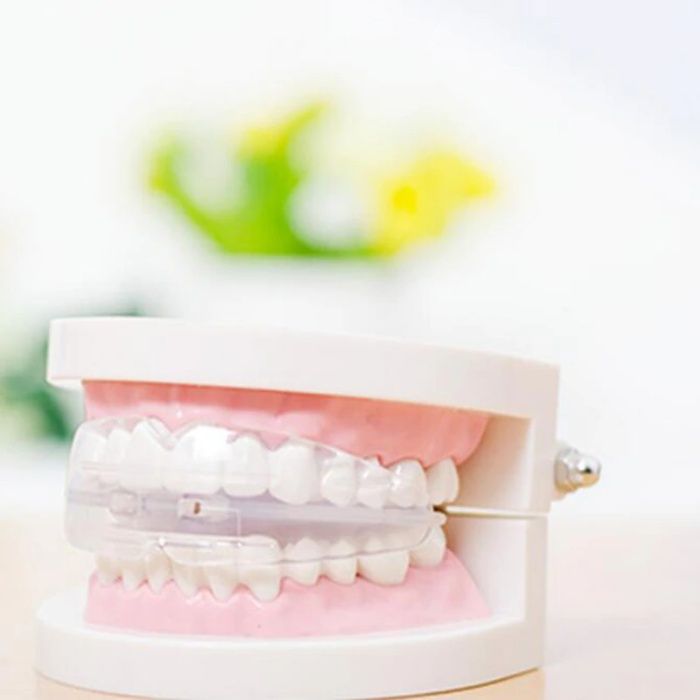 Стоматологичен ортодонтски коректор на зъби