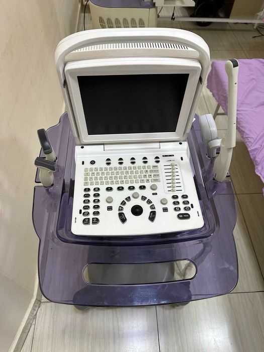 УЗИ аппарат портативный CHISON