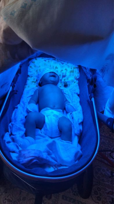 Аренда фотолампы от желтушки