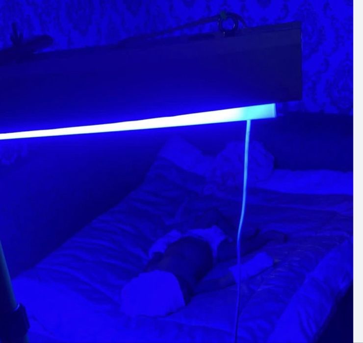 Фотолампа от желтушки