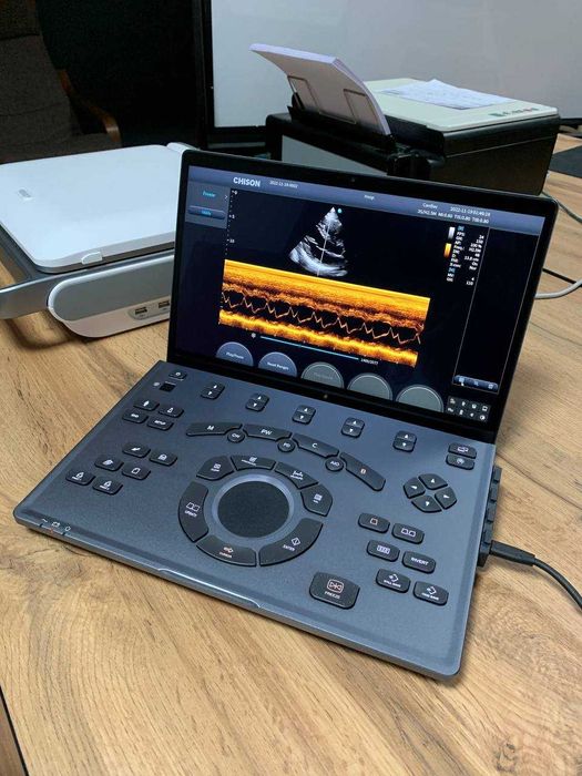 Портативный УЗИ-аппарат CHISON SonoBook 7