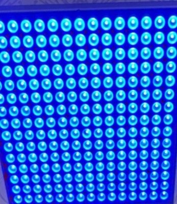 Fotolampa chaqaloqlardagi sariqlikni yo'qotish uchun fototetapiya