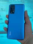 Redmi note 11 sotiladi ideal