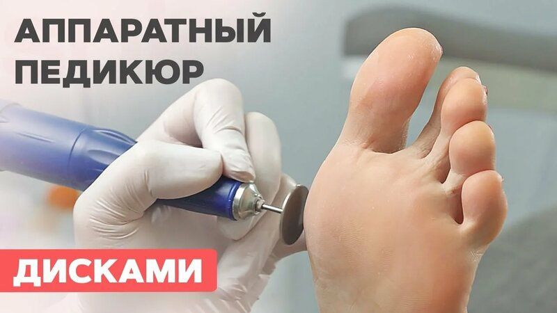 Аппаратный педикюр