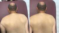 Мануальная терапия костоправ массаж лечение грыж