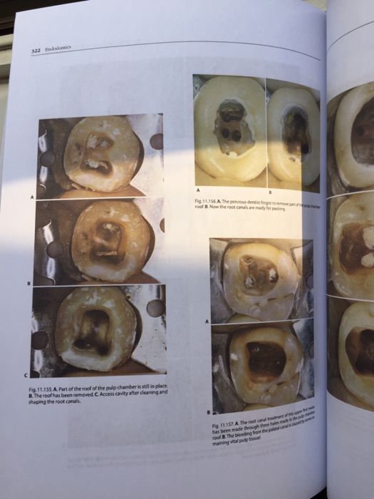 Endodontics CASTELLUCCI vol.1 Editia 2009