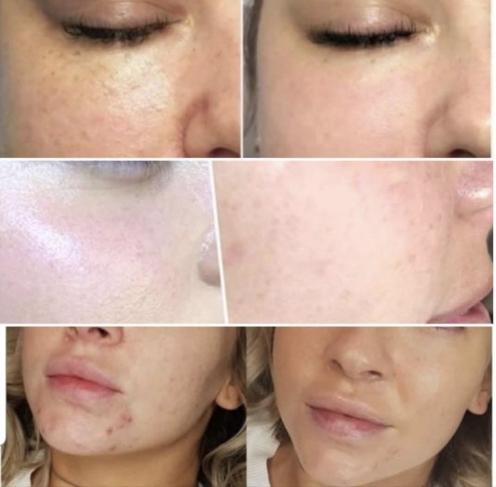 Micropigmentare Oradea