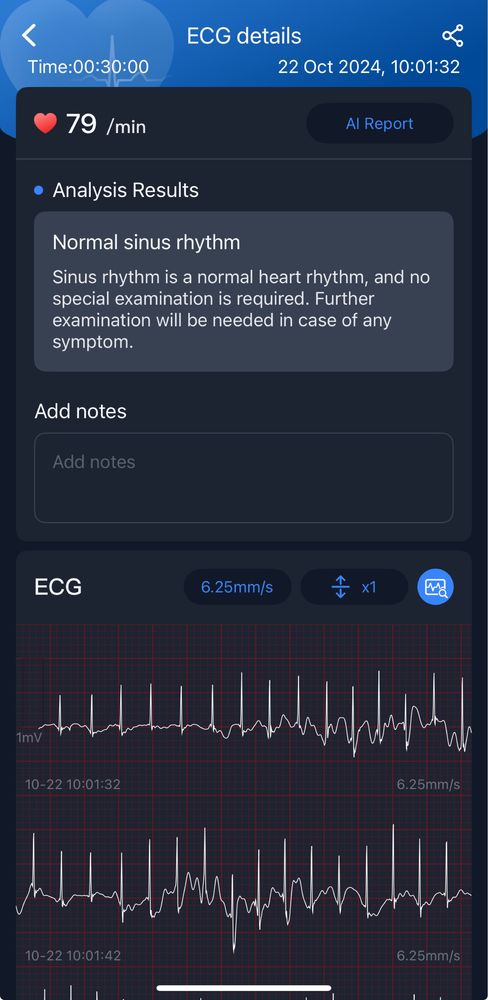 ECG/EKG 24-часов холтер Wellue