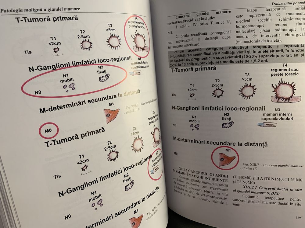 Tratat oncologie Patologia maligna a glandei mamare Prof Bădulescu