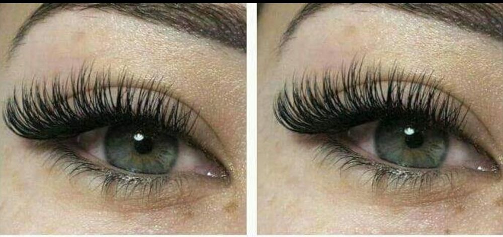 Gene extensii professional