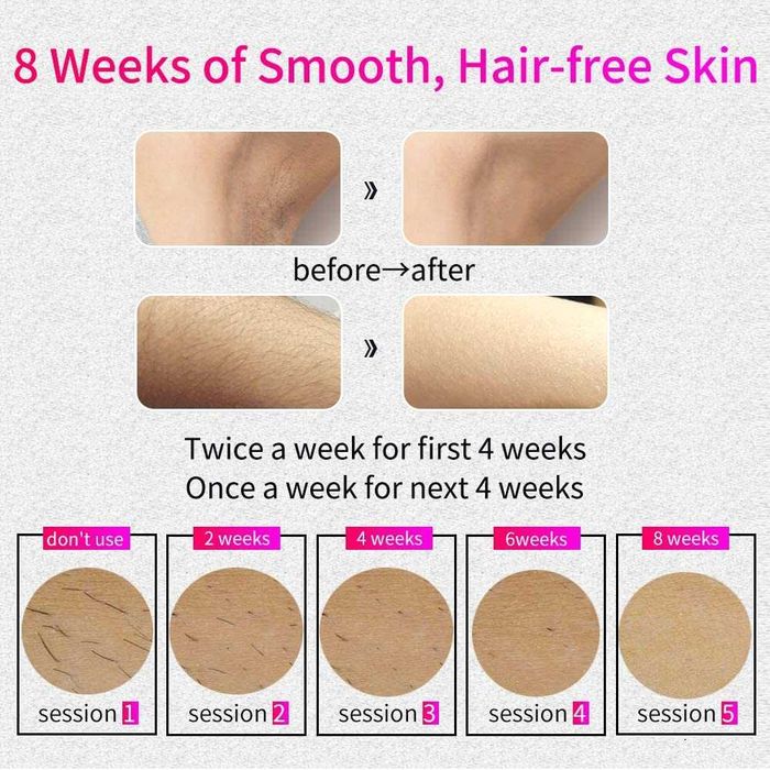 VEME IPL Epilator Permanent definitiv cu 500000 pulsatii - Nou