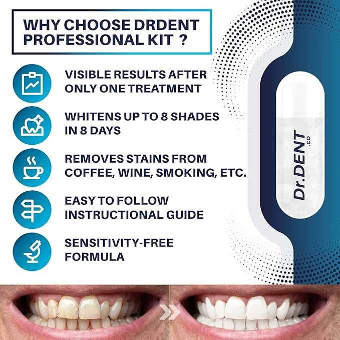 Професионален LED комплект за избелване на зъби DrDent