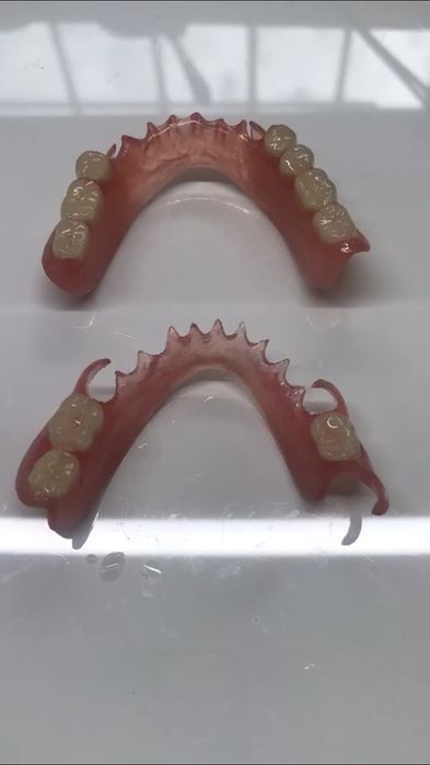 Протезы зубные, Изготовим простые, нейлоновые и термобюгельные протезы