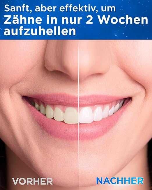 Електрическа звукова четка за зъби Sonic Y05 8 глави и 5 режима черна