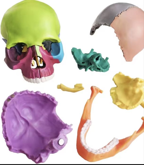 craniu medicina